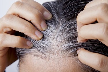 Young woman with white hair at scalp
